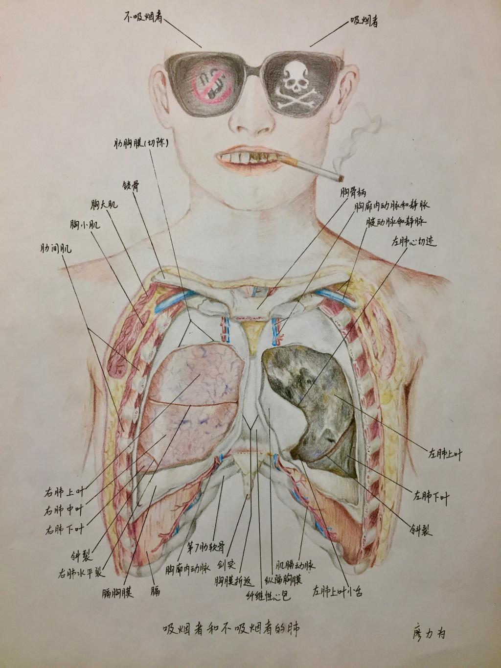 腹部影像学解剖图谱，详细篇！_医学